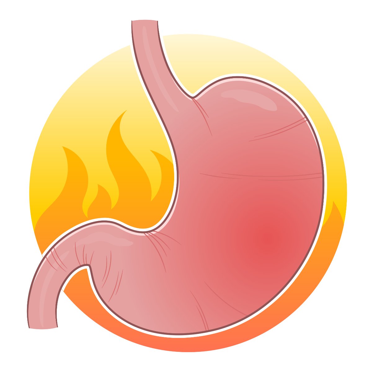 Le RGO ou reflux gastro-œsophagien est une maladie bénigne qui se caractérise par une remontée acide de l’estomac vers l’œsophage.